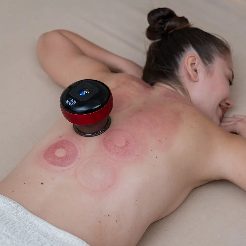 TrendRehab - Elektrisk cupping 12 nivåer