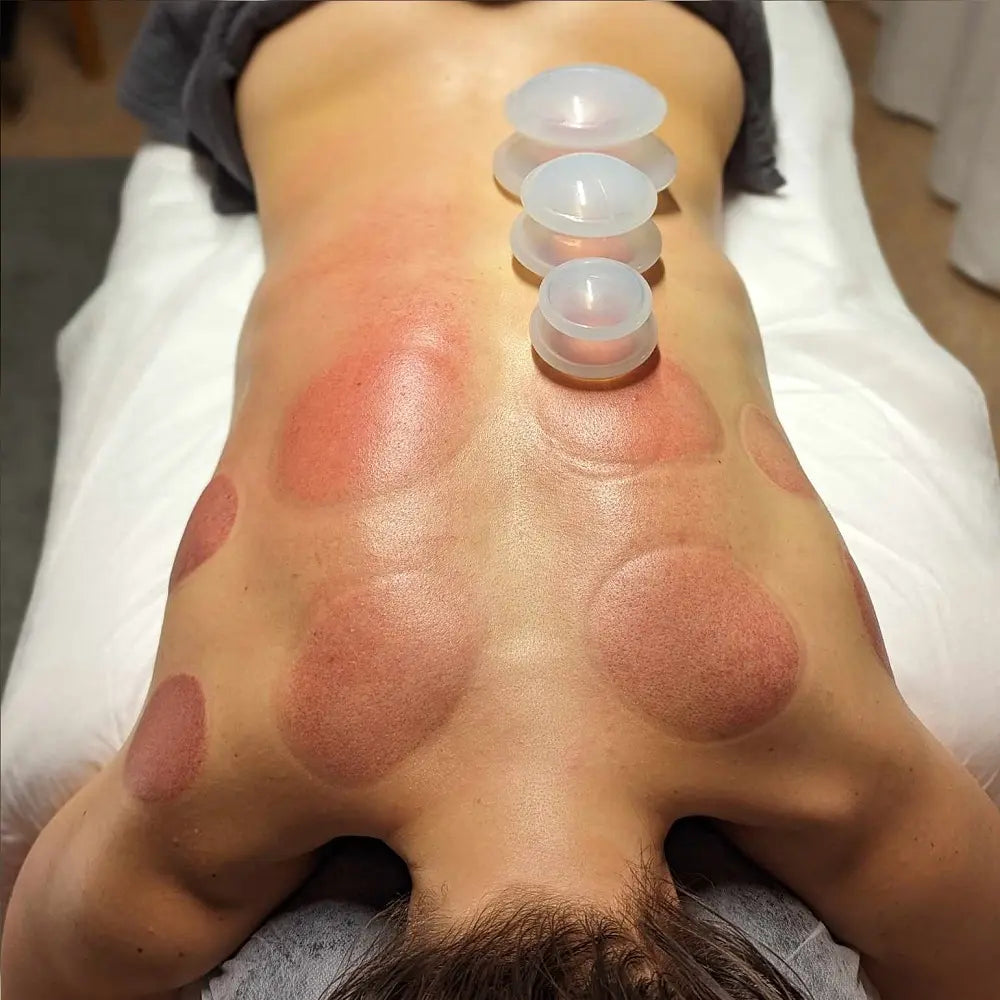 TrendRehab - CuppingSet – Effektiv och avslappnande massage för hela kroppen