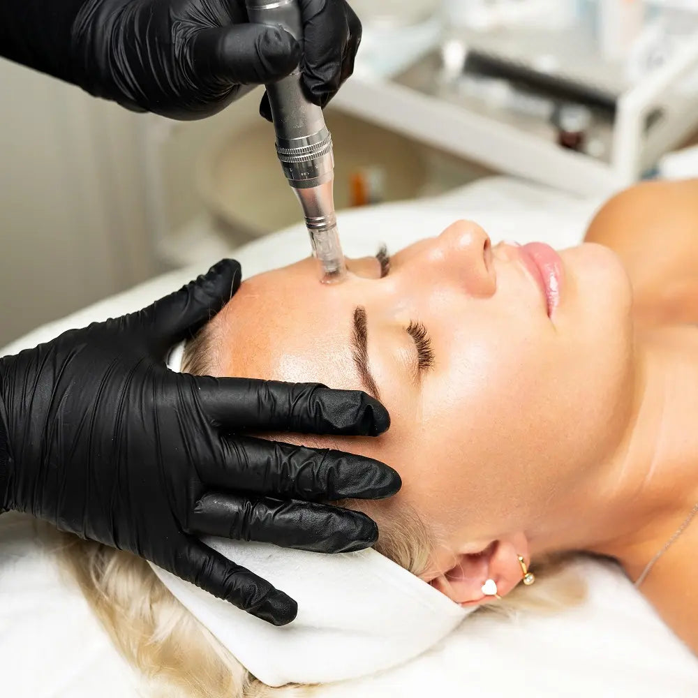 TrendRehab - MicroneedlingPen